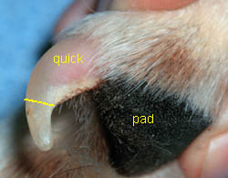 toenail including labeled quick and line designating area to cut